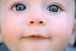 рождение больных детей