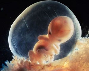 плохое развитие плода