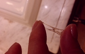 Коричневая овуляция