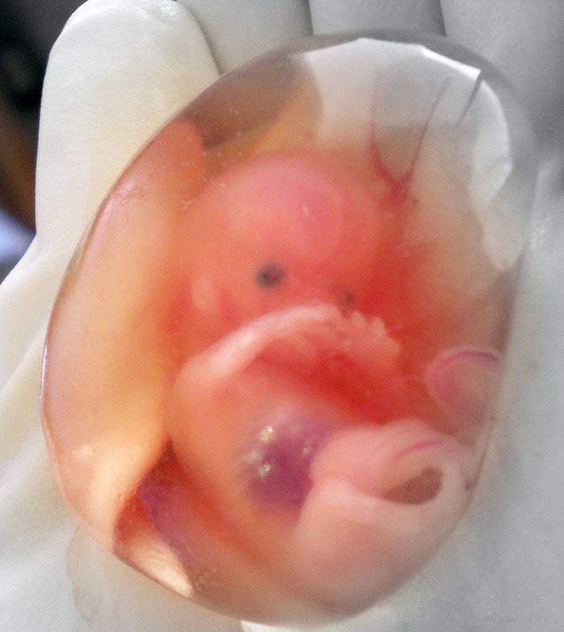 Первый аборт 2