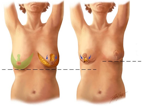 Кормление грудью , одна больше другой 1